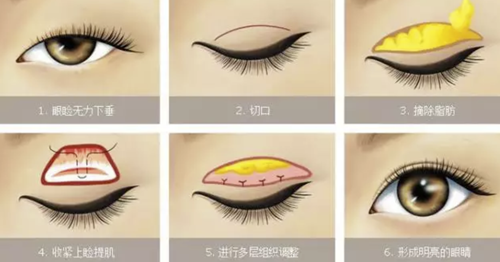 18135718263161701_5.png 18135718263161701_5.png